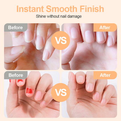 📢📢50% DE RÉDUCTION !! ⏰Coupe-ongles et polisseur électrique intelligent 2-en-1🌟