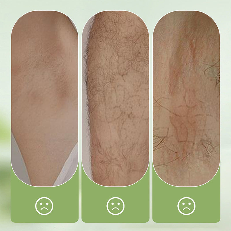 ⏰LAST DAY: only £8.99 ‼️💥Large-size hair removal cream Gentle and non-irritating hair removal cream set (hair removal cream + razor)🎁