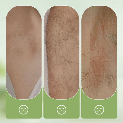 ⏰LAST DAY: only £8.99 ‼️💥Large-size hair removal cream Gentle and non-irritating hair removal cream set (hair removal cream + razor)🎁